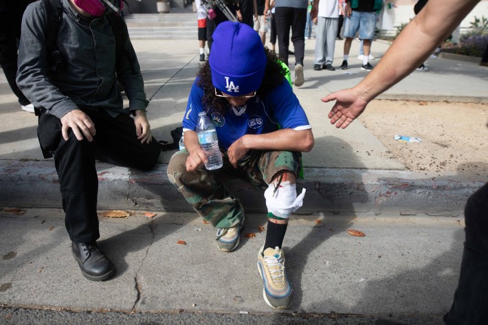 A hurt demonstrator at downtown L.A.'s peaceful protest on No Kings Day.