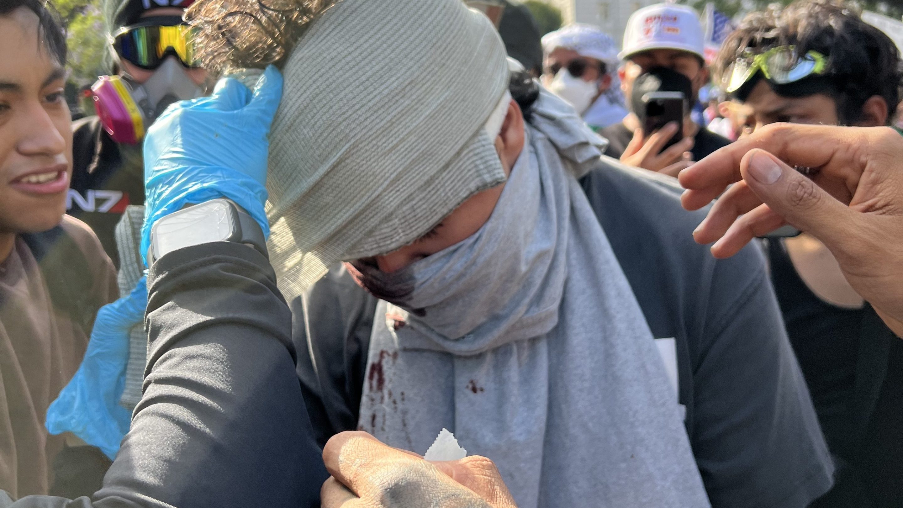 A group of people surround a young man who has a bandage wrapped around their head and a t-shirt over the mouth.