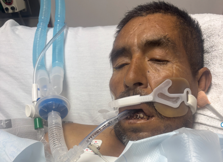 a man is intubated at a hospital