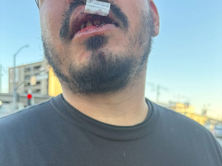 a close-up of a man with a busted lip